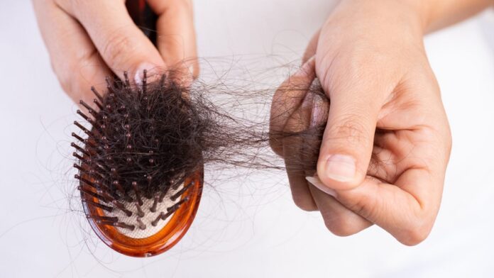 Hair Care: हमेशा के लिए बालों का झड़ना बंद कर देंगी ये 5 चीजें, जानिए क्या है ये चीजे