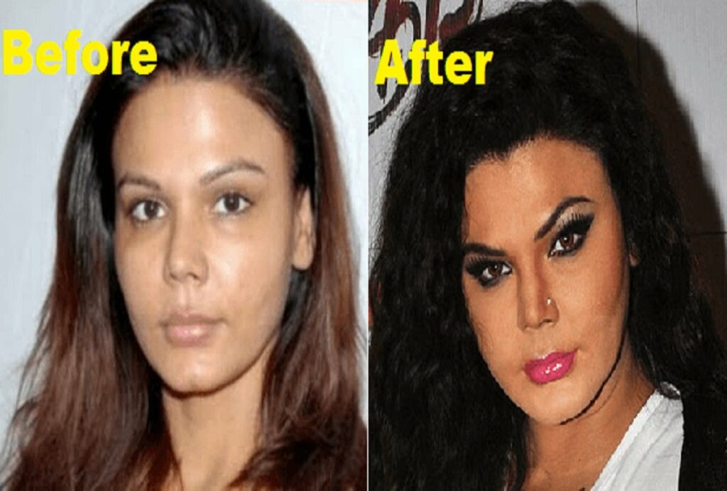rakhi sawant before and after plastic surgery