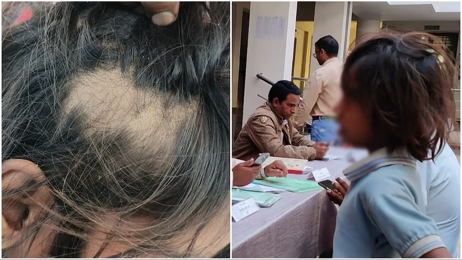अंग्रेजी न पढ़ पाने की वजह से शिक्षिका ने छात्रा की जमकर की पिटाई, जिससे उखड गए सर के बाल